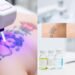 tattoo ink elimination methods