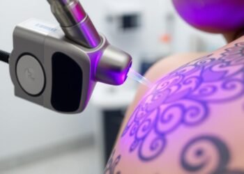 tattoo removal solutions